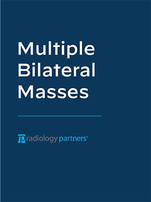 A dark blue cover with the text Multiple Bilateral Masses in large white letters, referencing breast cancer, and radiology partners with its logo in smaller text at the bottom.