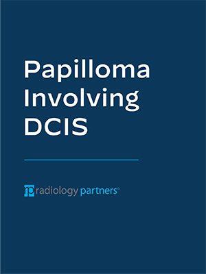 Dark blue cover with large white text reading Rare Male DCIS, highlighting a breast cancer case. Below, a thin blue line and the Radiology Partners logo and name in smaller blue and white text.