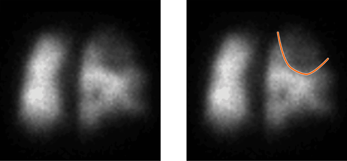 Two blurry grayscale images side by side show vague shapes. The right image has an orange curved line drawn over its upper right area, while the left image has no markings, illustrating a typical scenario in Rad to Rad Learning visualizations.