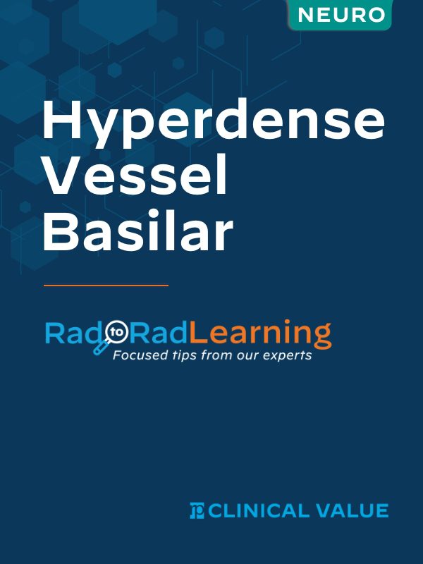 Hyperdense Vessel Basilar